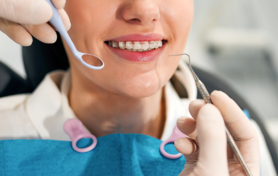 correction sourire andilly dr papelard Appareil dentaire (métal ou céramique) Ermont Eaubonne Orthodontie