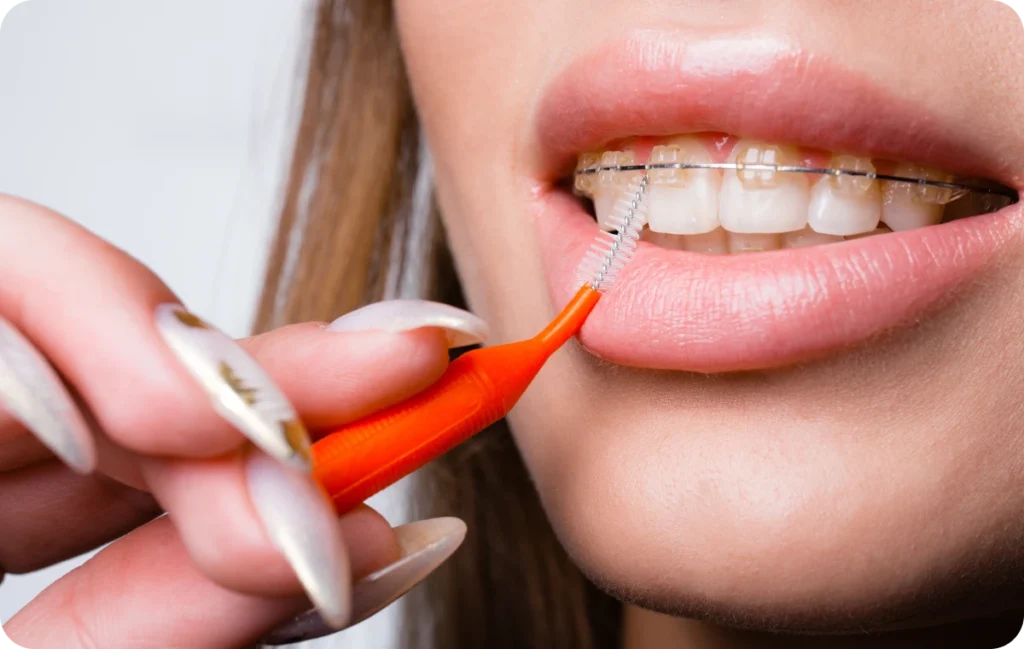 traitements chirurgicaux andilly dr papelard Appareil dentaire (métal ou céramique) Ermont Eaubonne Orthodontie