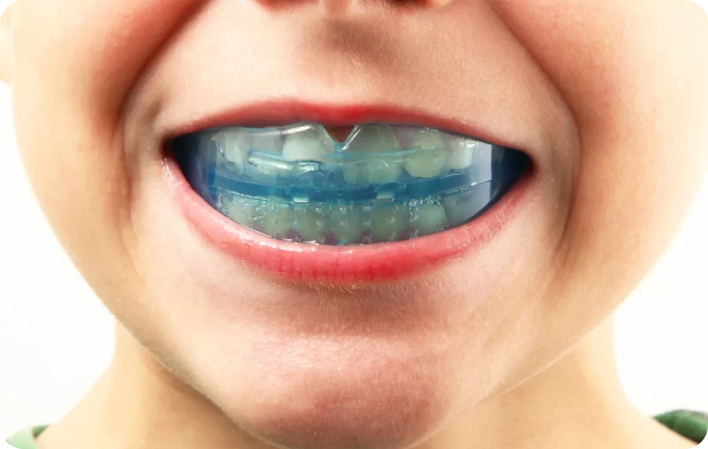 traitements chirurgicaux enghien les bains Orthodontie fonctionnelle Ermont Eaubonne Orthodontie
