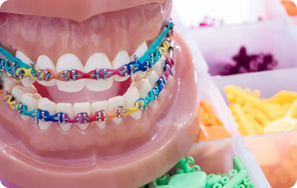 traitements chirurgicaux le plessis bouchard Appareil dentaire (métal ou céramique) Ermont Eaubonne Orthodontie