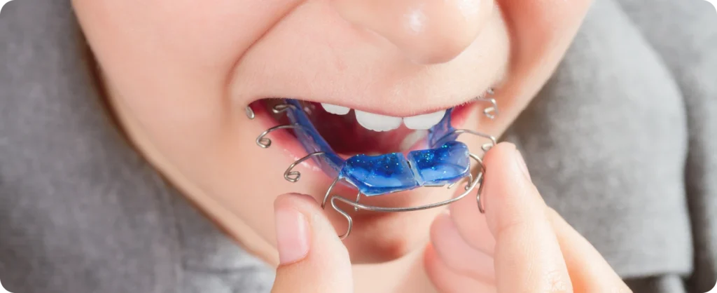 traitements chirurgicaux saint prix dr foucart traitements chirurgicaux saint prix dr foucart Orthodontie interceptive Ermont Eaubonne Orthodontie