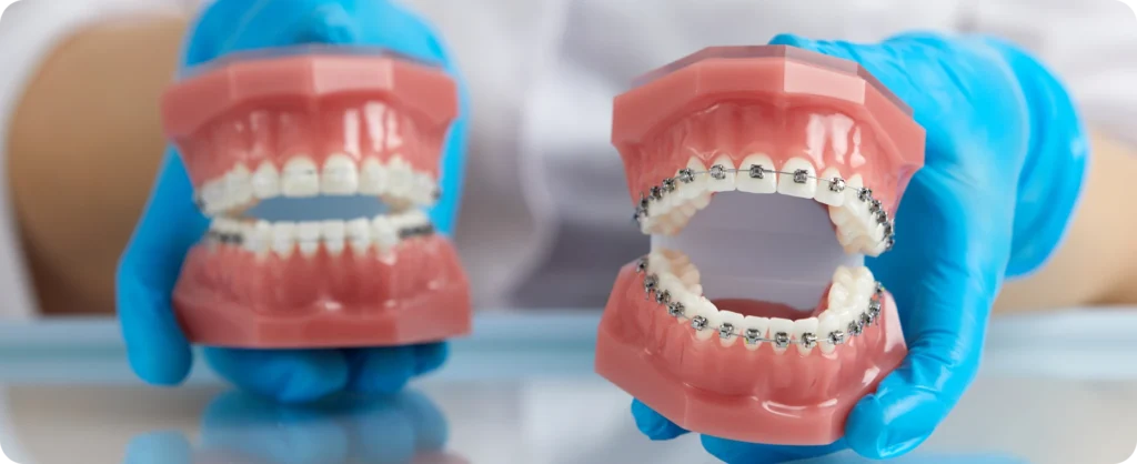 traitements chirurgicaux soisy sous montmorency Appareil dentaire (métal ou céramique) Ermont Eaubonne Orthodontie
