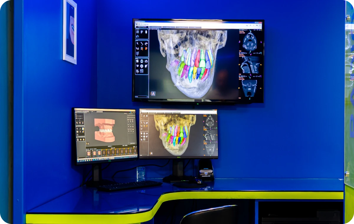 correction dentaire ermont eaubonne Nos technologies Ermont Eaubonne Orthodontie