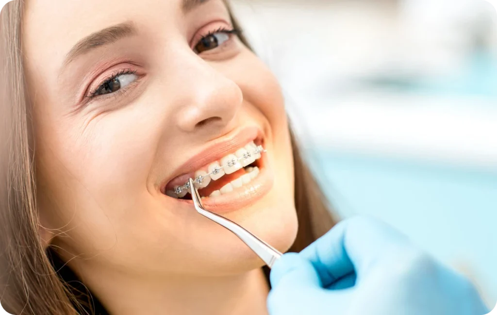 multi bagues adolescents multi bagues adolescents Orthodontiste Le Plessis-Bouchard Ermont Eaubonne Orthodontie