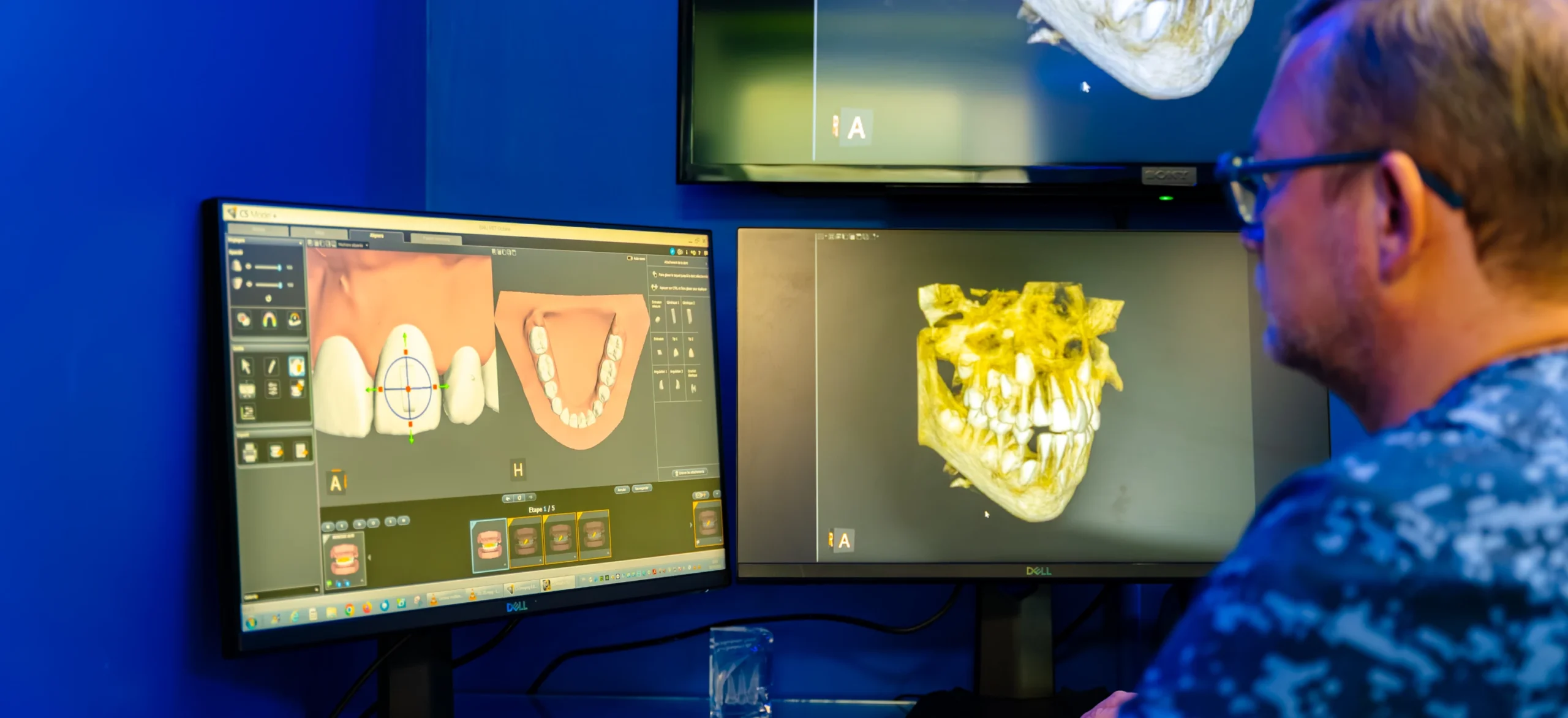 orthodontie fonctionnelle enfant eaubonne scaled Notre cabinet Ermont Eaubonne Orthodontie