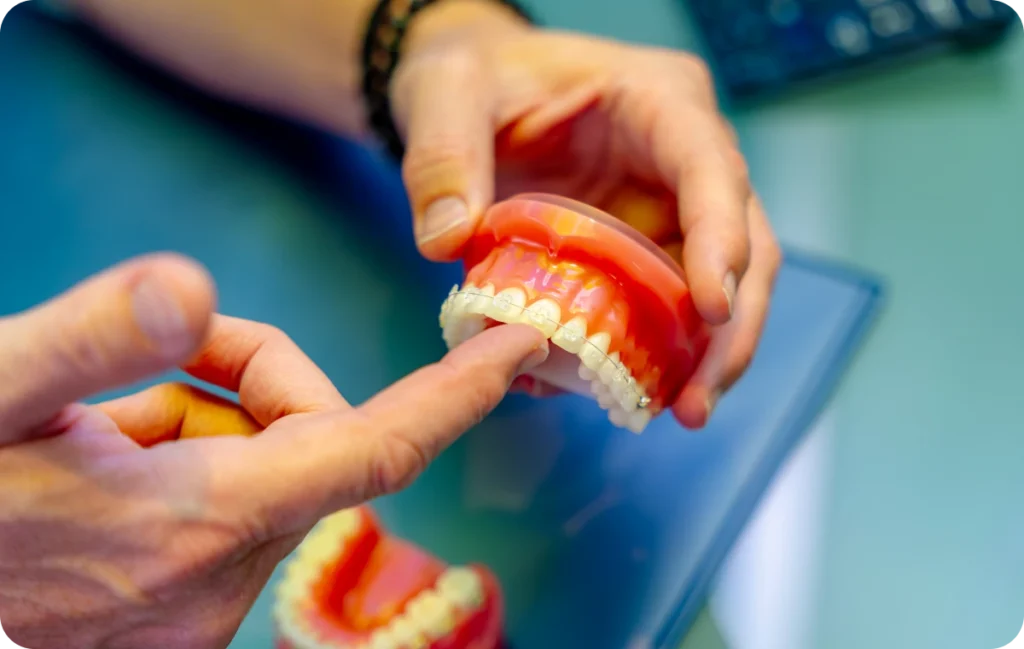 orthodontiste eaubonne aligneurs transparents orthodontiste eaubonne aligneurs transparents Orthodontiste Montigny-les-Cormeilles Ermont Eaubonne Orthodontie