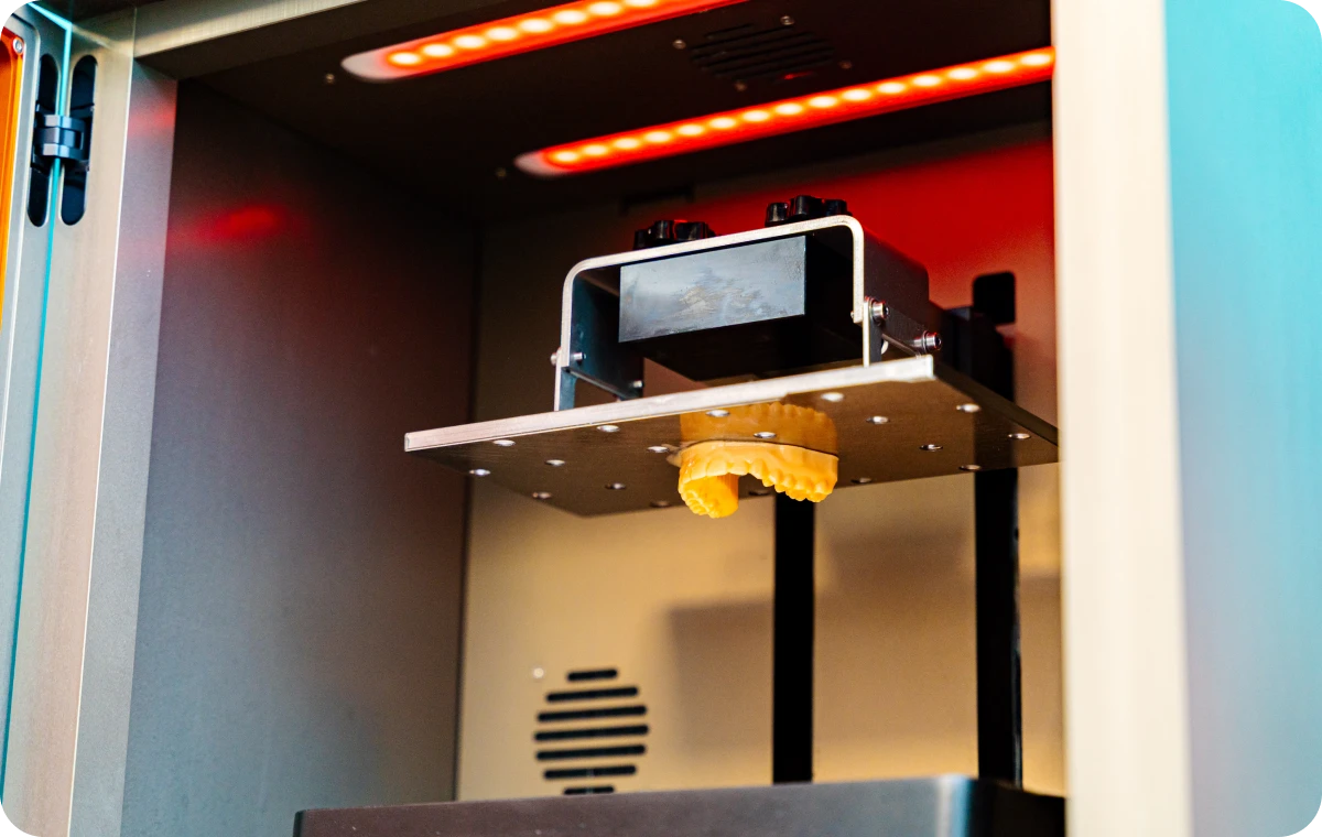 sourire esthetique eaubonne orthodontiste Nos technologies Ermont Eaubonne Orthodontie