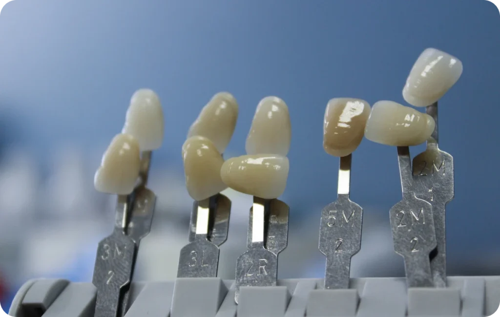 traitement appareil dentaire eaubonne Éclaircissement dentaire Ermont Eaubonne Orthodontie